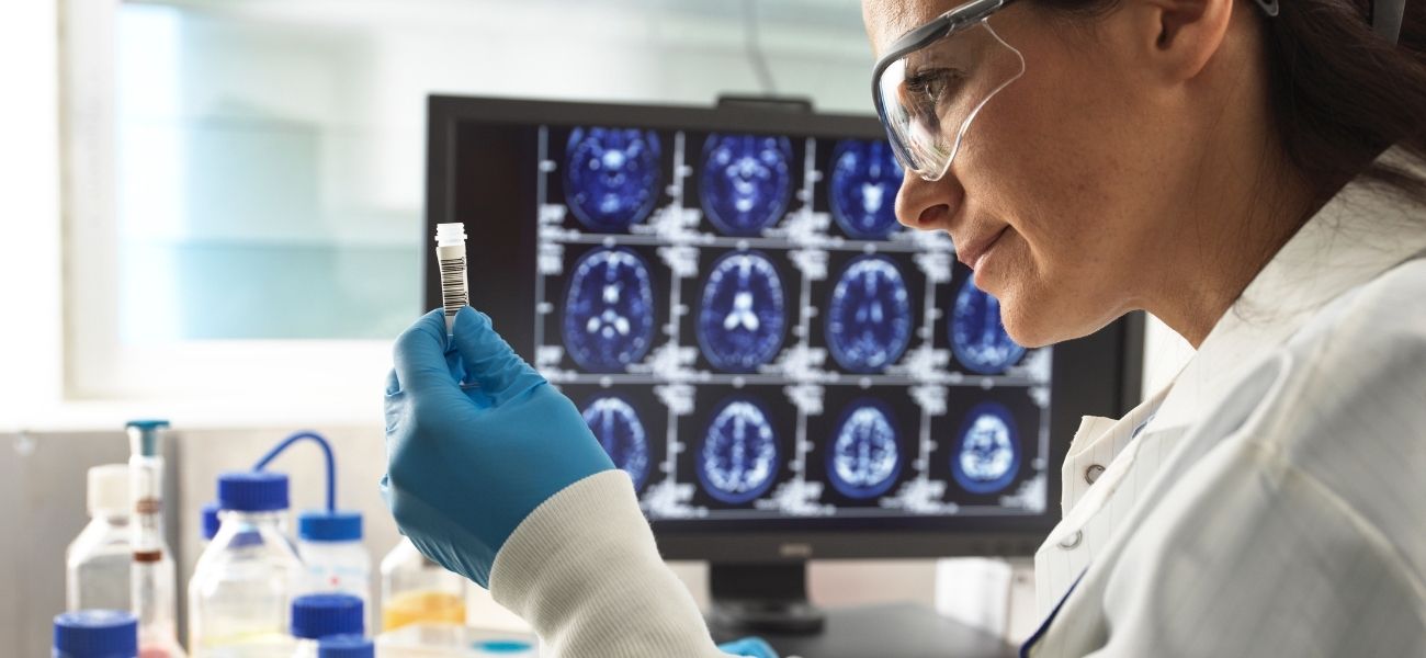 Azul de metileno para Alzheimer